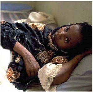 This young Ethiopian woman is suffering from AIDS. Fully 71 per cent of the globe’s disease burden from HIV-AIDS, tuberculosis (TB) and malaria falls on sub-Saharan Africa. (Photo: UN Photo/Louise Gubb)