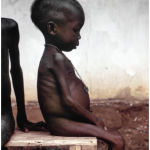 The West was horrified in 1968 by images of starving Biafran children such as this one. Biafra's attempts to secede from Nigeria led to a civil war that displaced millions and killed two million more. (Photo: Dr. Lyle Conrad)