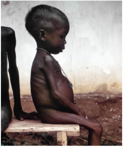 The West was horrified in 1968 by images of starving Biafran children such as this one. Biafra's attempts to secede from Nigeria led to a civil war that displaced millions and killed two million more.  (Photo: Dr. Lyle Conrad)