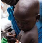 This toddler took part in the UNICEF/WFP Joint Nutrition Response Plan for South Sudan in Aweil, Northern Bahr el Ghazal State. (Photo: UN PHOTO)