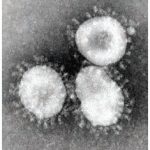 Coronaviruses are a group that have a halo, or crown-like (corona) appearance. (Photo: CDC/Dr. Fred Murphy)