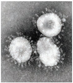 Coronaviruses are a group that have a halo, or crown-like (corona) appearance. (Photo: CDC/Dr. Fred Murphy)