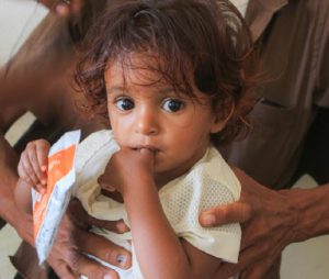 A Yemeni child holds some food from a World Food Programme (WFP) at a WFP-supported nutrition clinic treating malnutrition among children. (Photo: WFP/Issa-Al-Raghi)